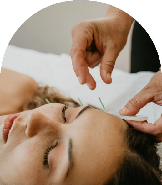 Microneedling and facial treatment session
