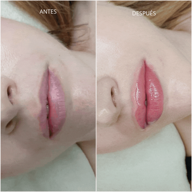 Resultado real Lip Touch