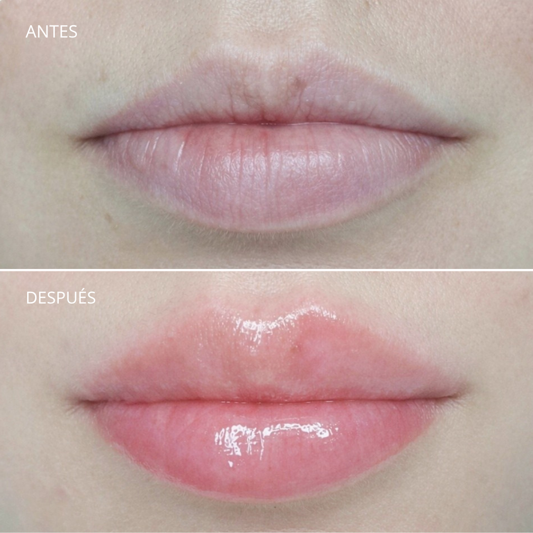 Resultado Lip Touch Landi Studio