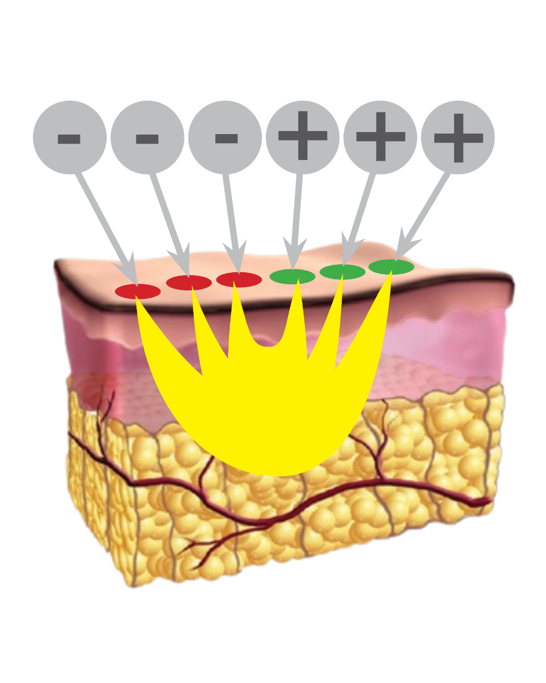 3DEEP RF diagram