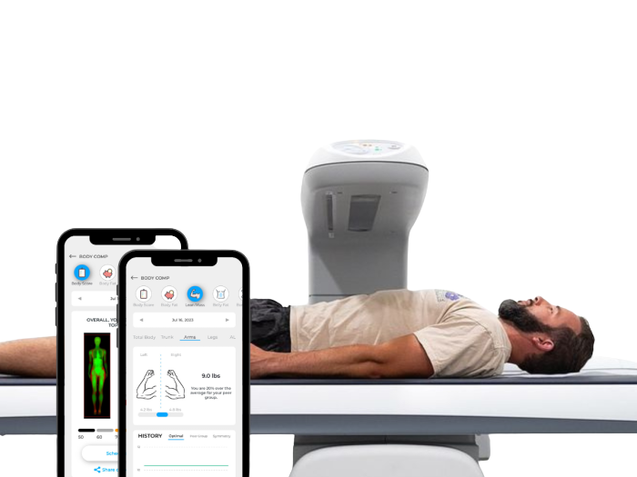 DEXA Scan