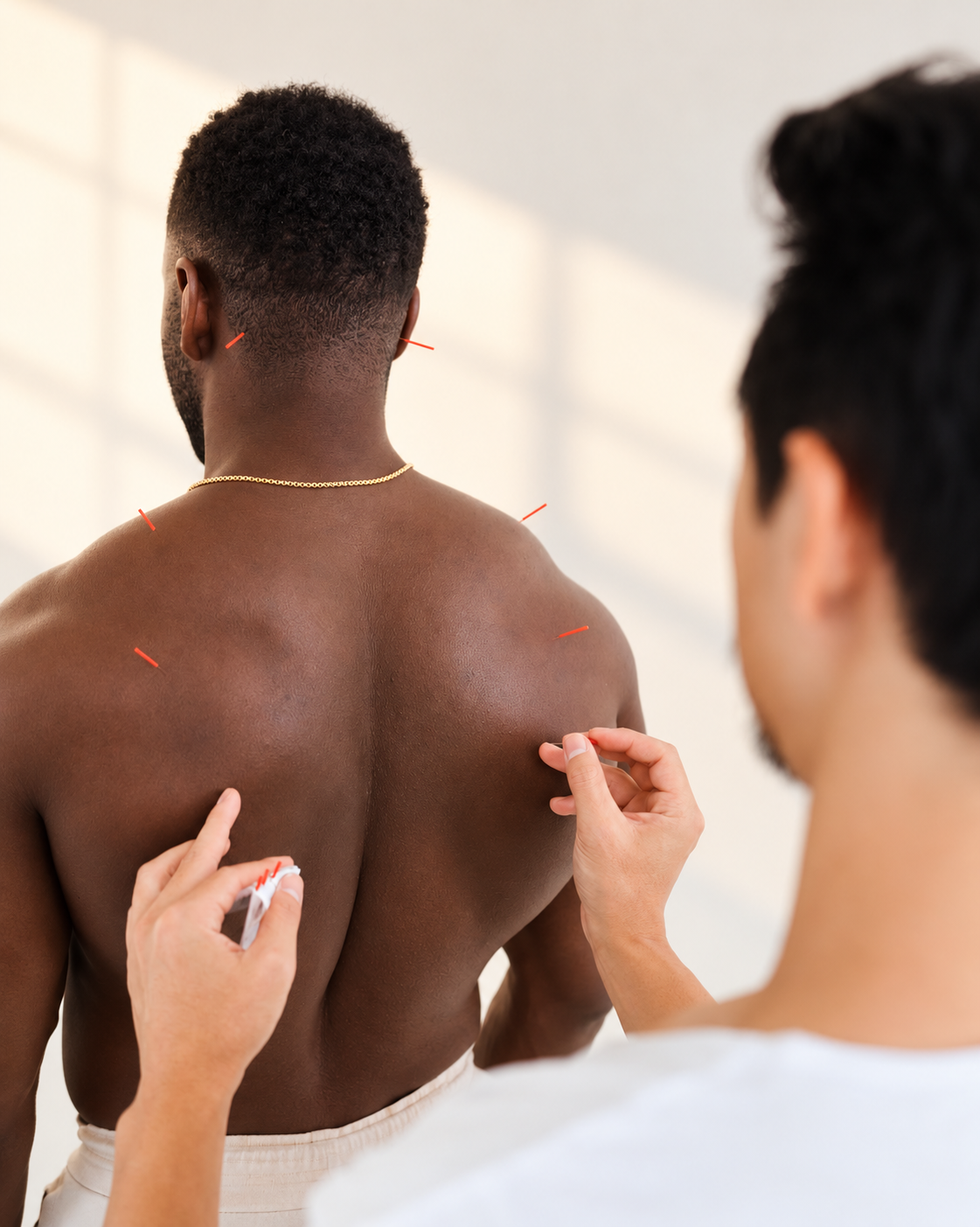 Dr. Phil placing acupuncture needles along a patient's upper back at ATRIUM