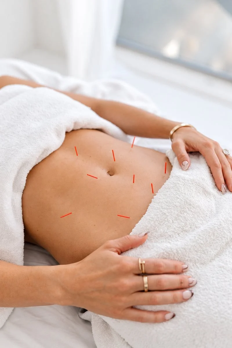 Abdominal acupuncture with soft ivory draping at ATRIUM