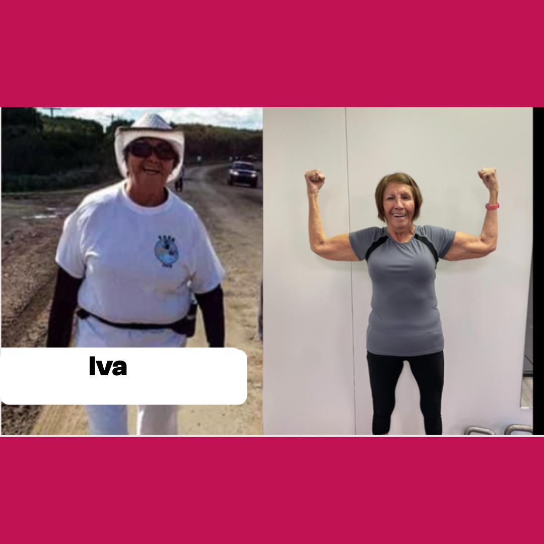 Iva before and after