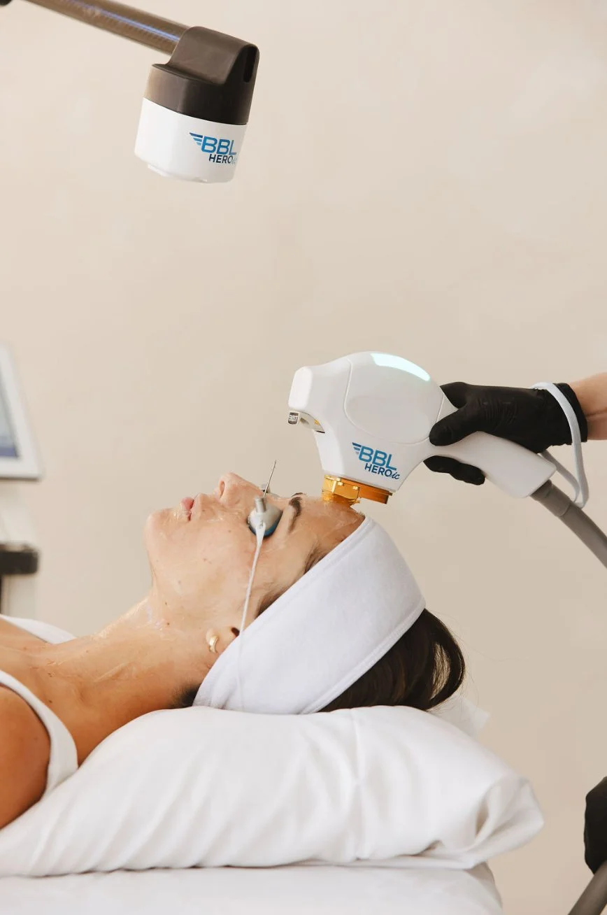 BBL HEROic forehead treatment close-up