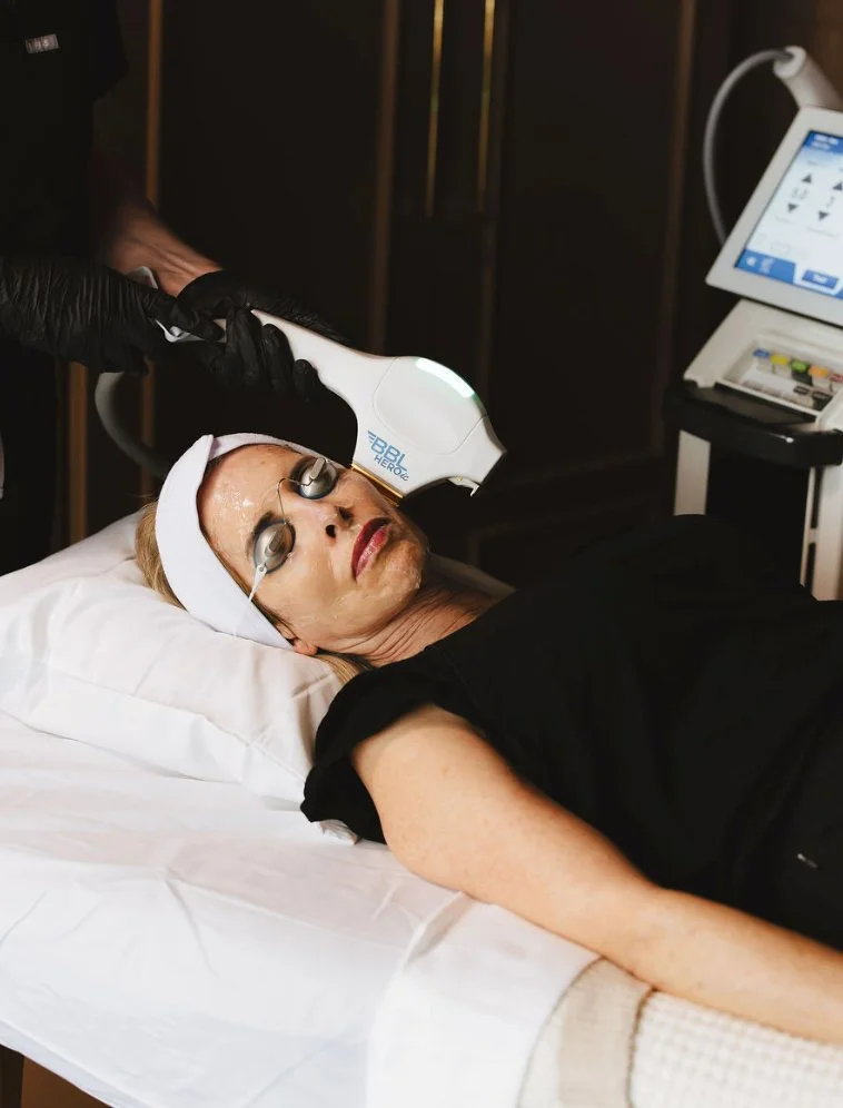 BBL HEROic treating cheek area