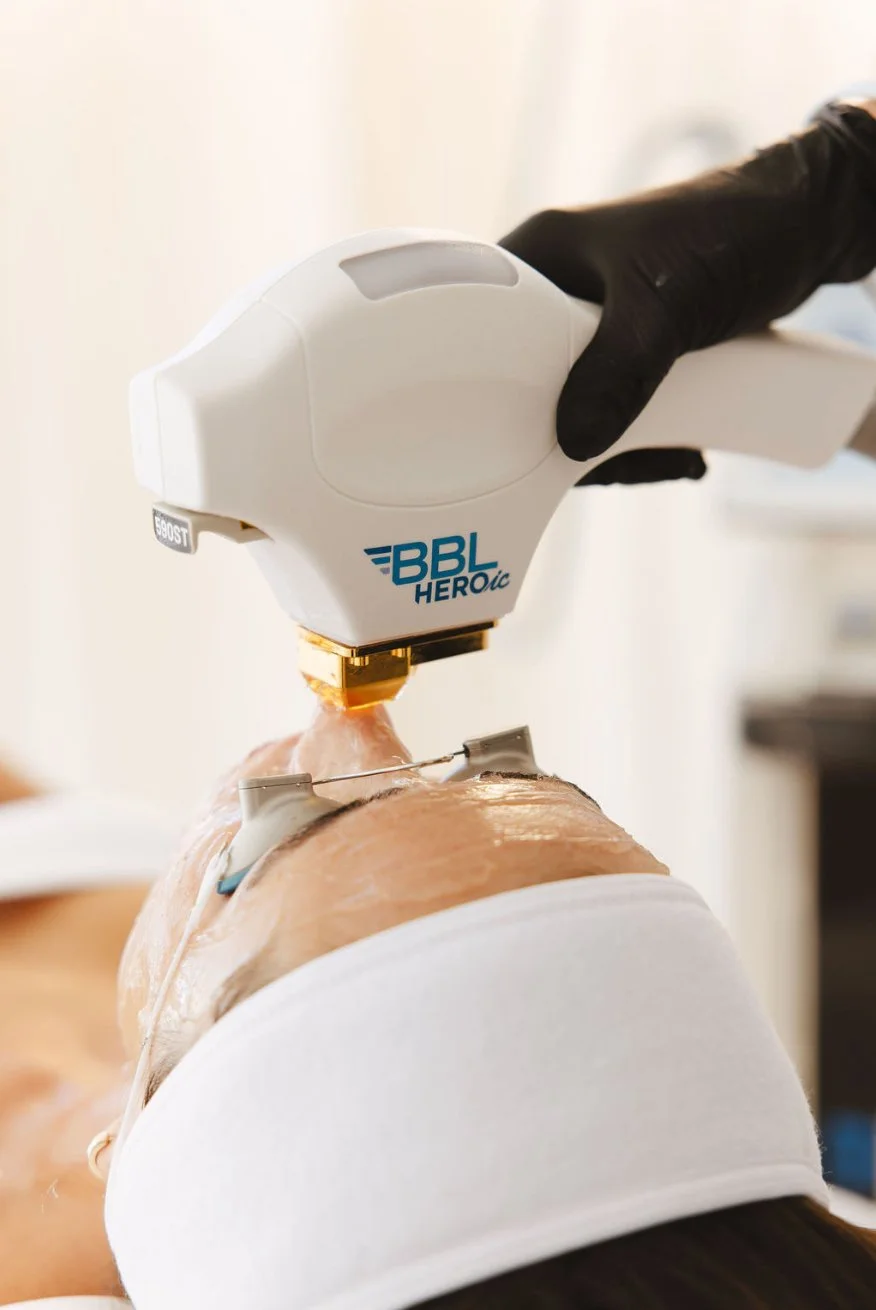 BBL HEROic treating nose area