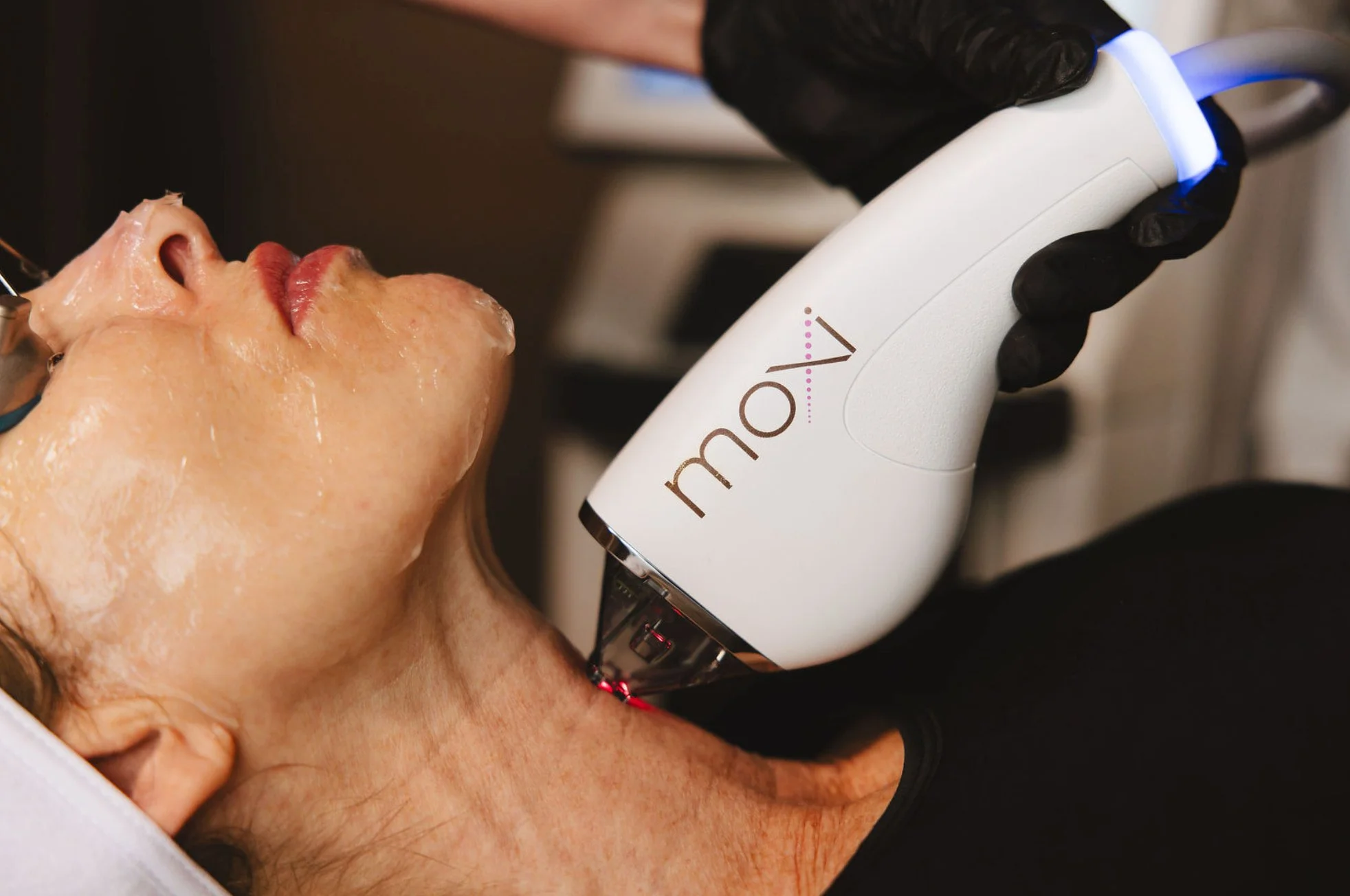 BBL HEROic and Moxi Laser machines at Alonso Aesthetics and Wellness Tampa FL