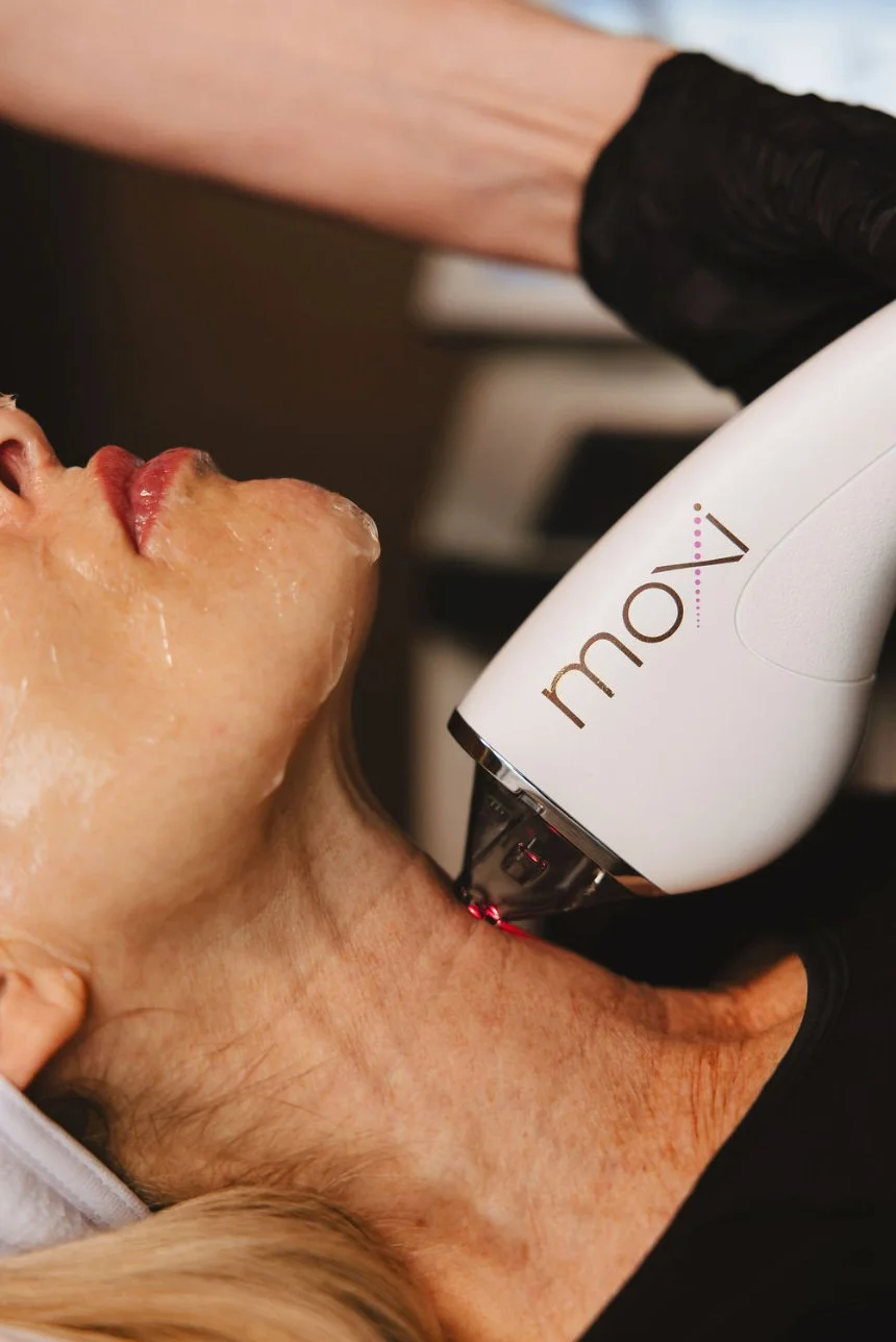 Moxi Laser neck treatment close-up