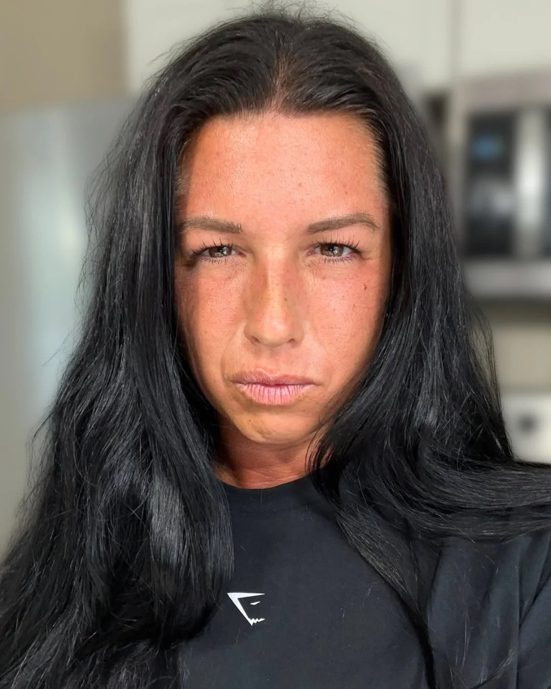 After Botox treatment