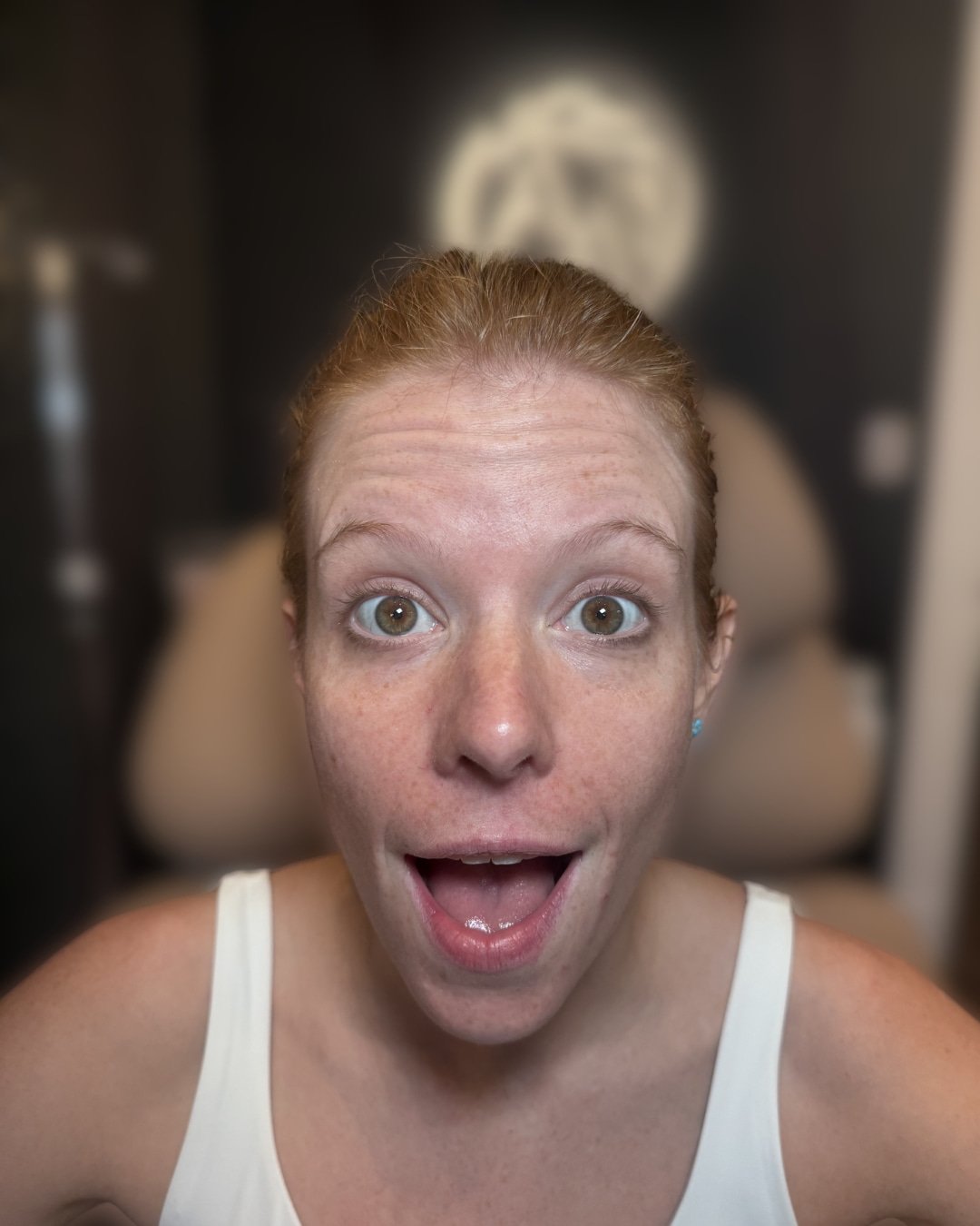 After Botox treatment