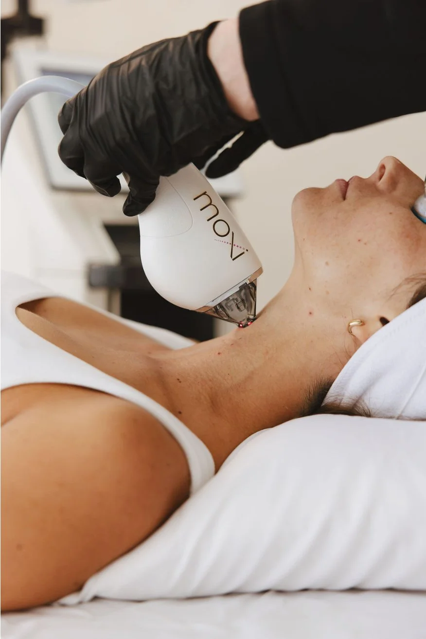 Moxi Laser treating neck area