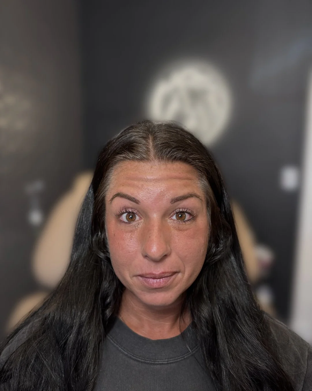 Before Botox treatment