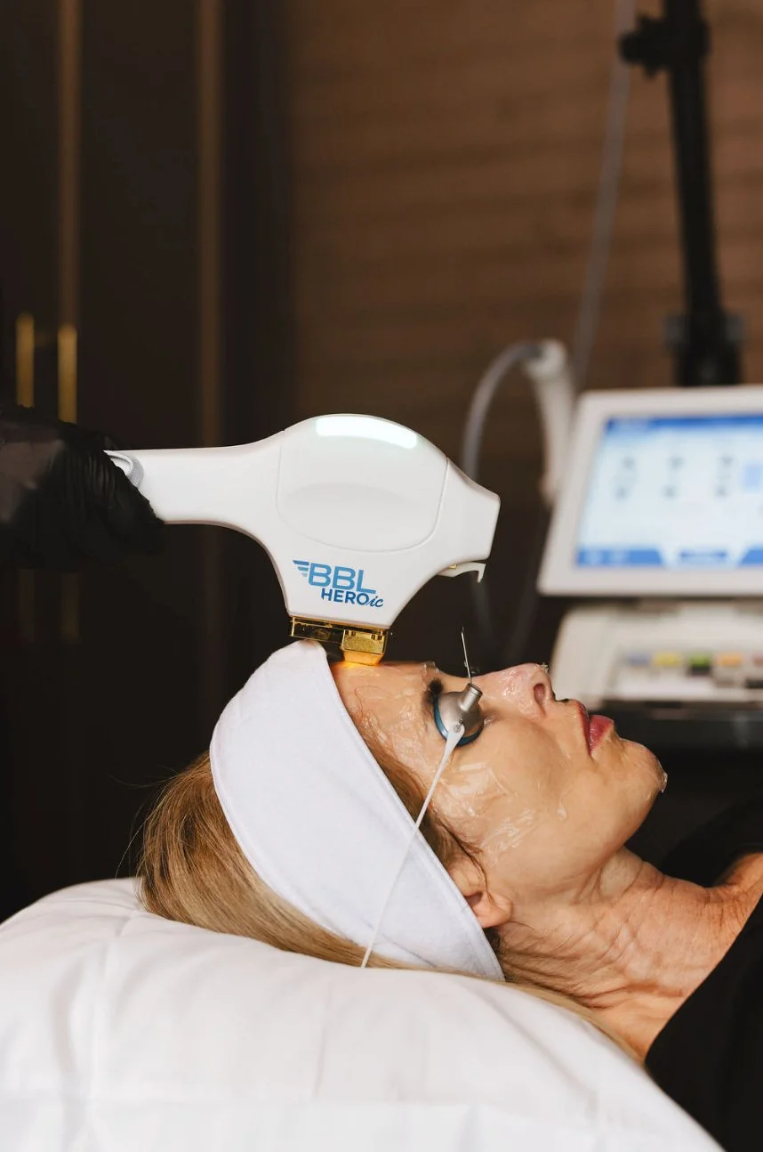 BBL HEROic forehead treatment