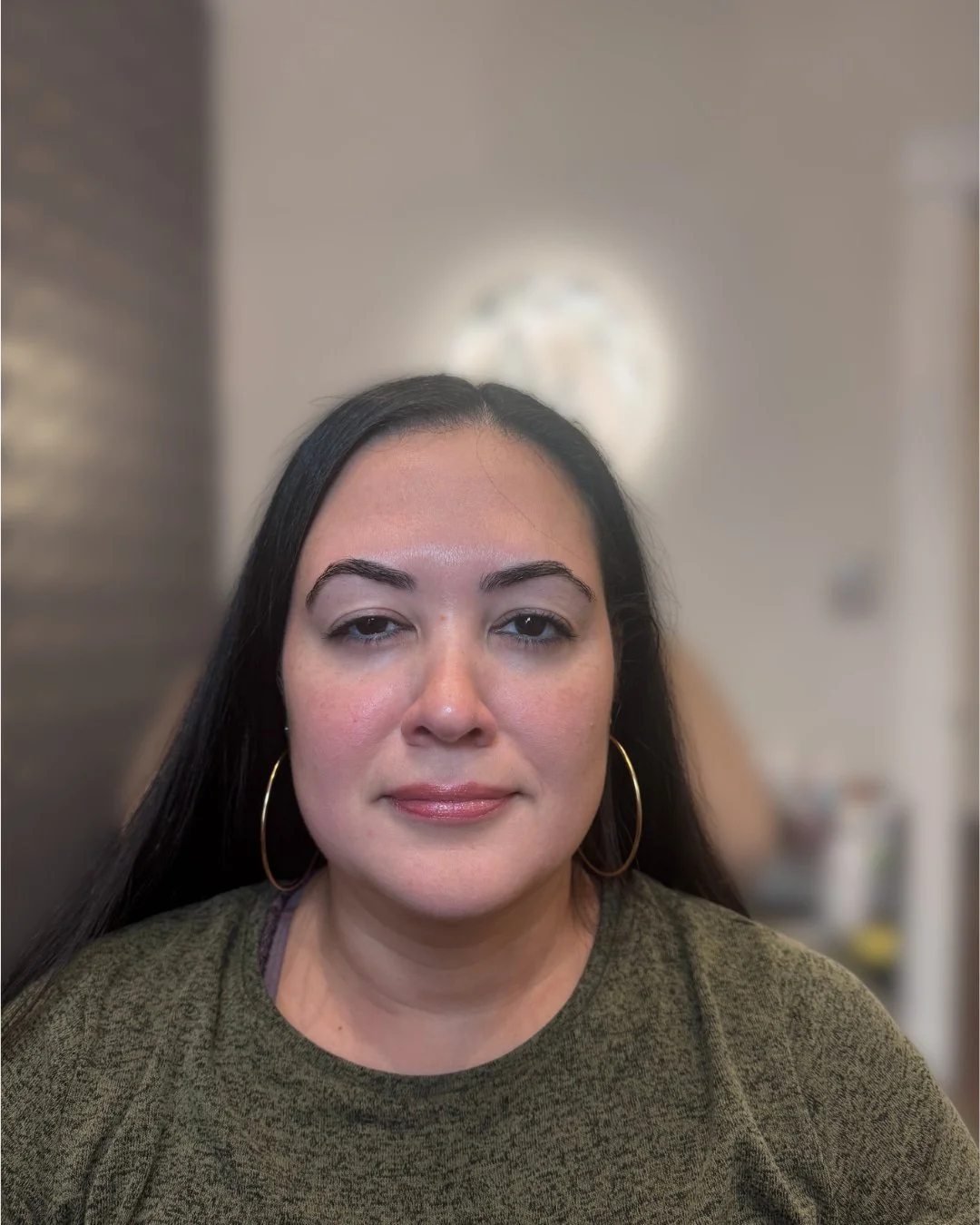 After Botox treatment