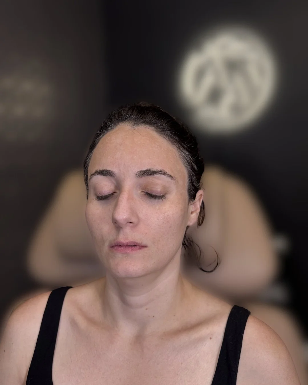 Before lip filler treatment