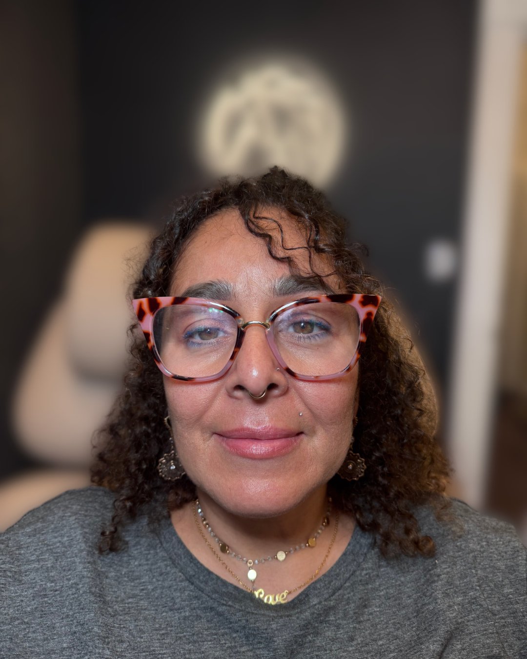 Loretta before smile line and lip filler treatment
