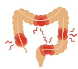 Bowel disease