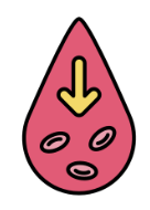 Pernicious anaemia