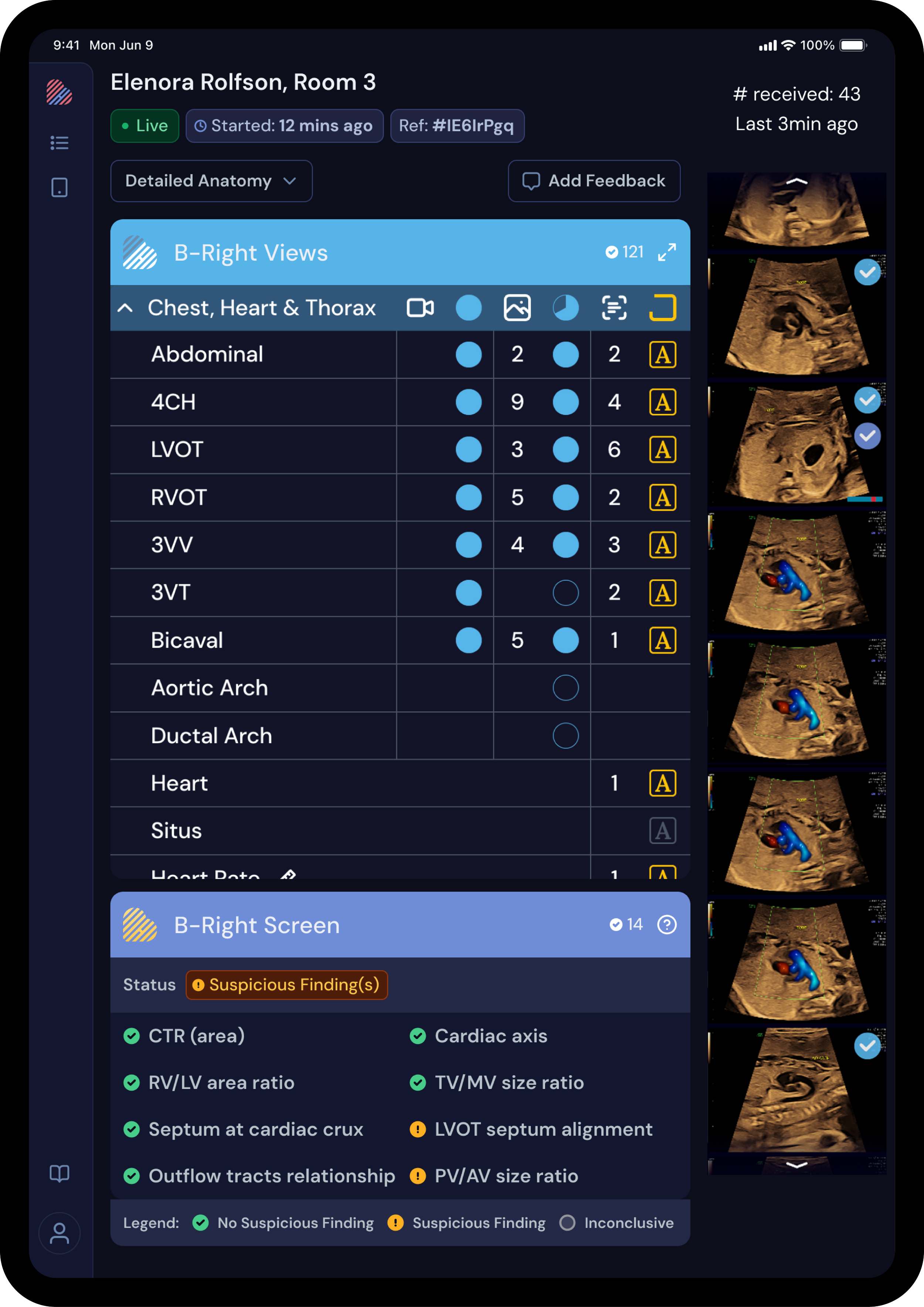 BrightHeart AI DICOM annotation interface