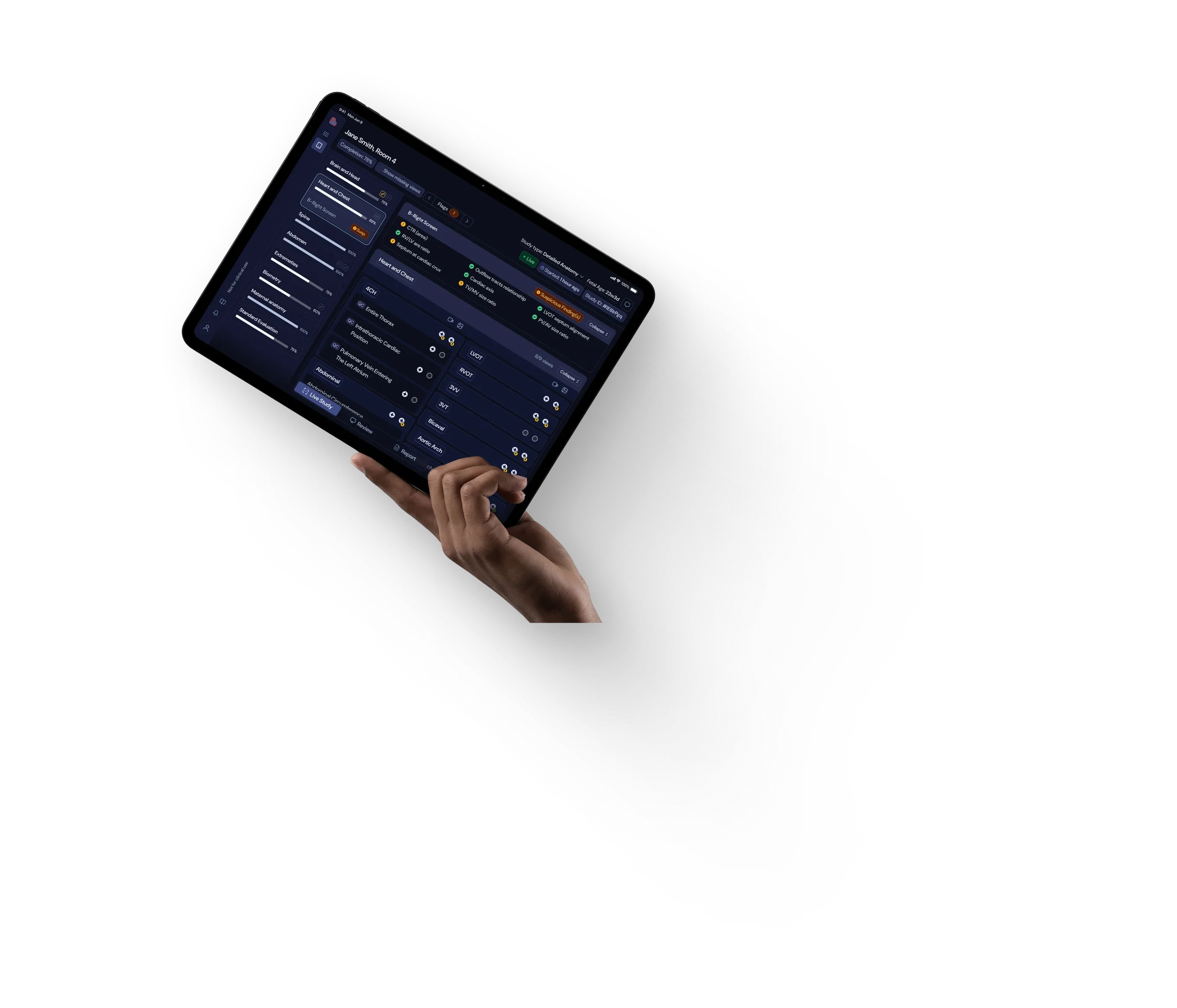 The B-Right app on a tablet held in one hand, showing B-Right Screen findings during a live study