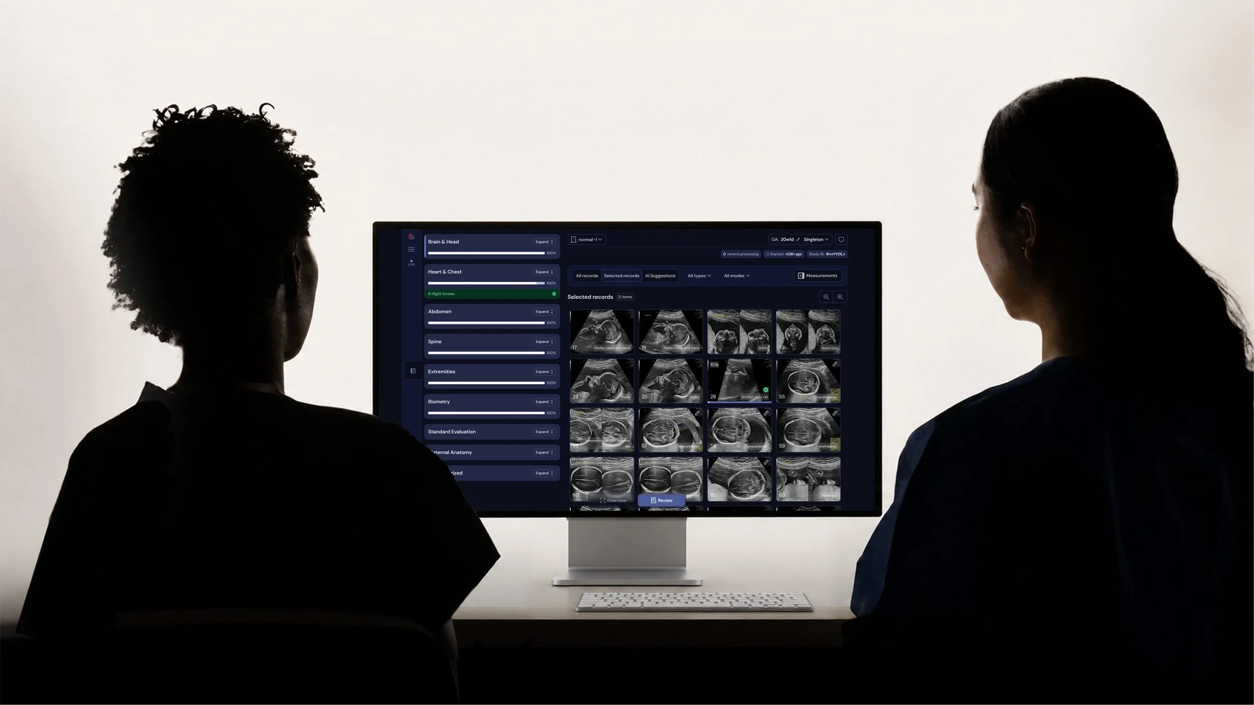 Two clinicians reviewing a fetal ultrasound exam on the B-Right AI Platform web viewer