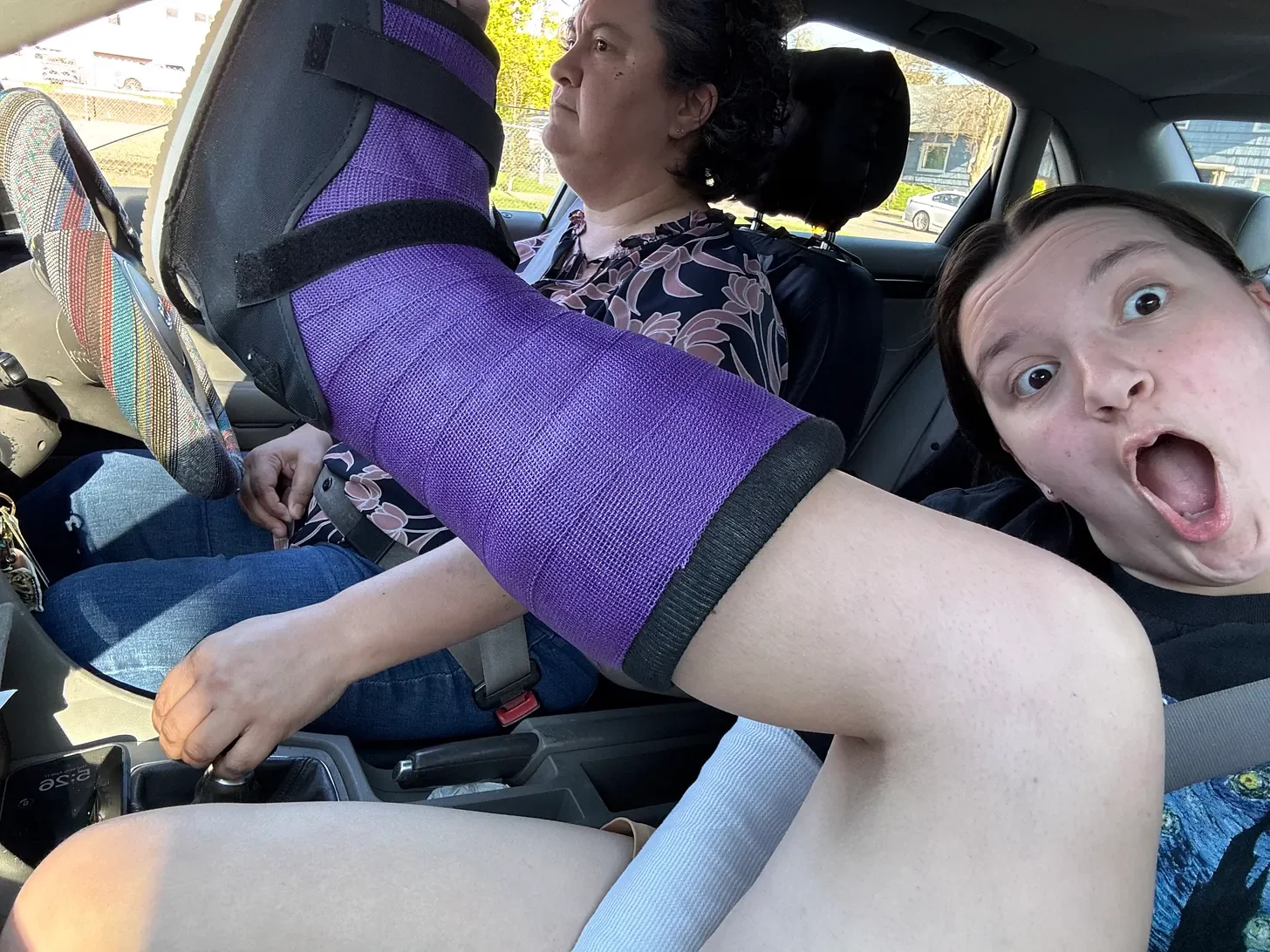 Kid with broken leg messing around