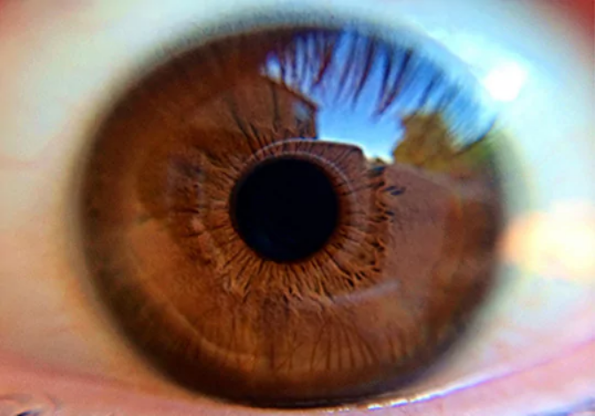 Early disease detection eye screening