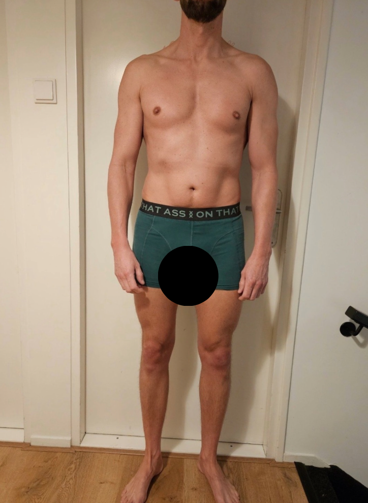 Dennis before