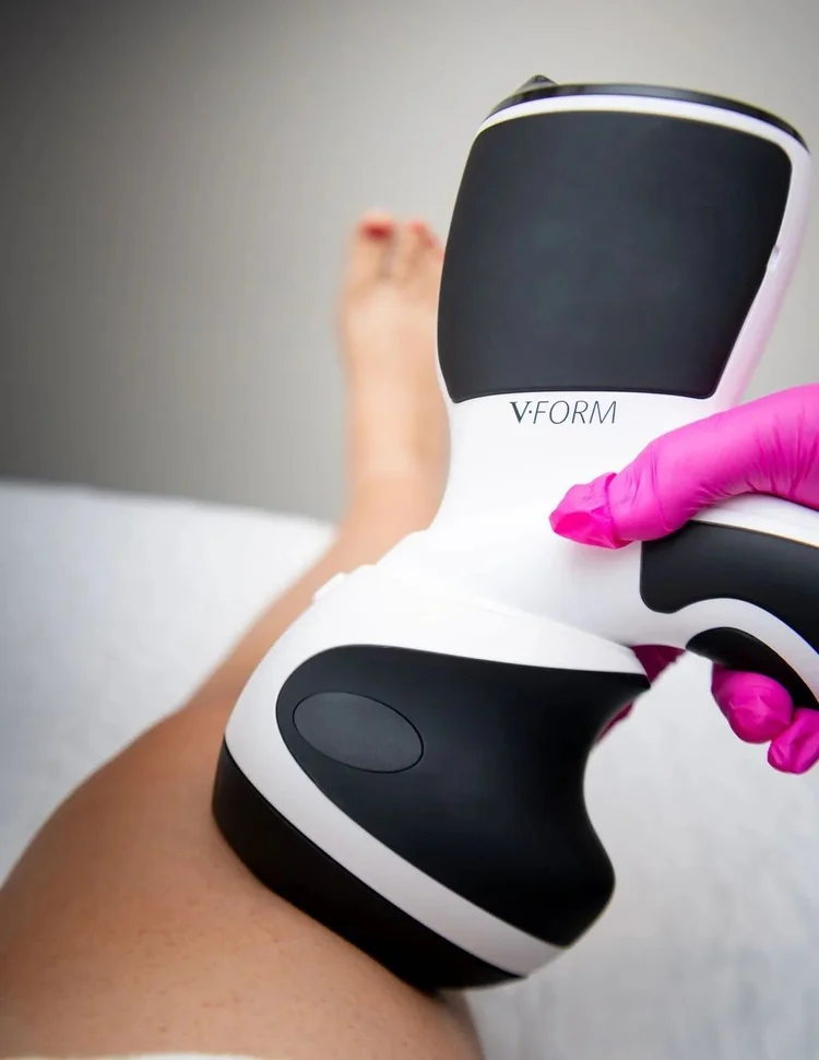 Viora V-Form body contouring on the thigh