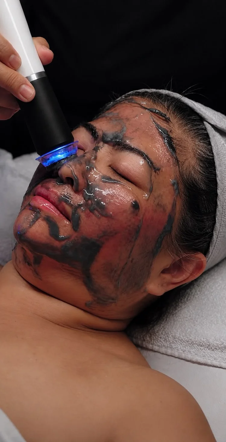 A Glo2Facial treatment with the oxygenating gel and handpiece