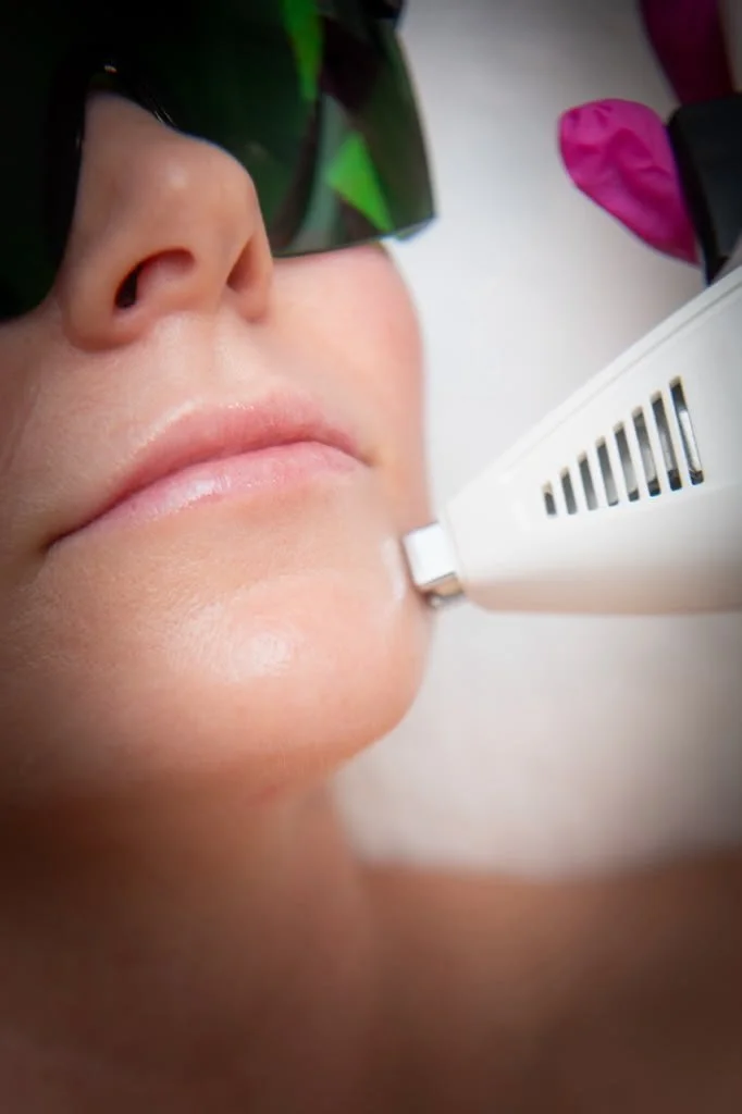Skin tightening at Tourmaline Skin Care & Laser