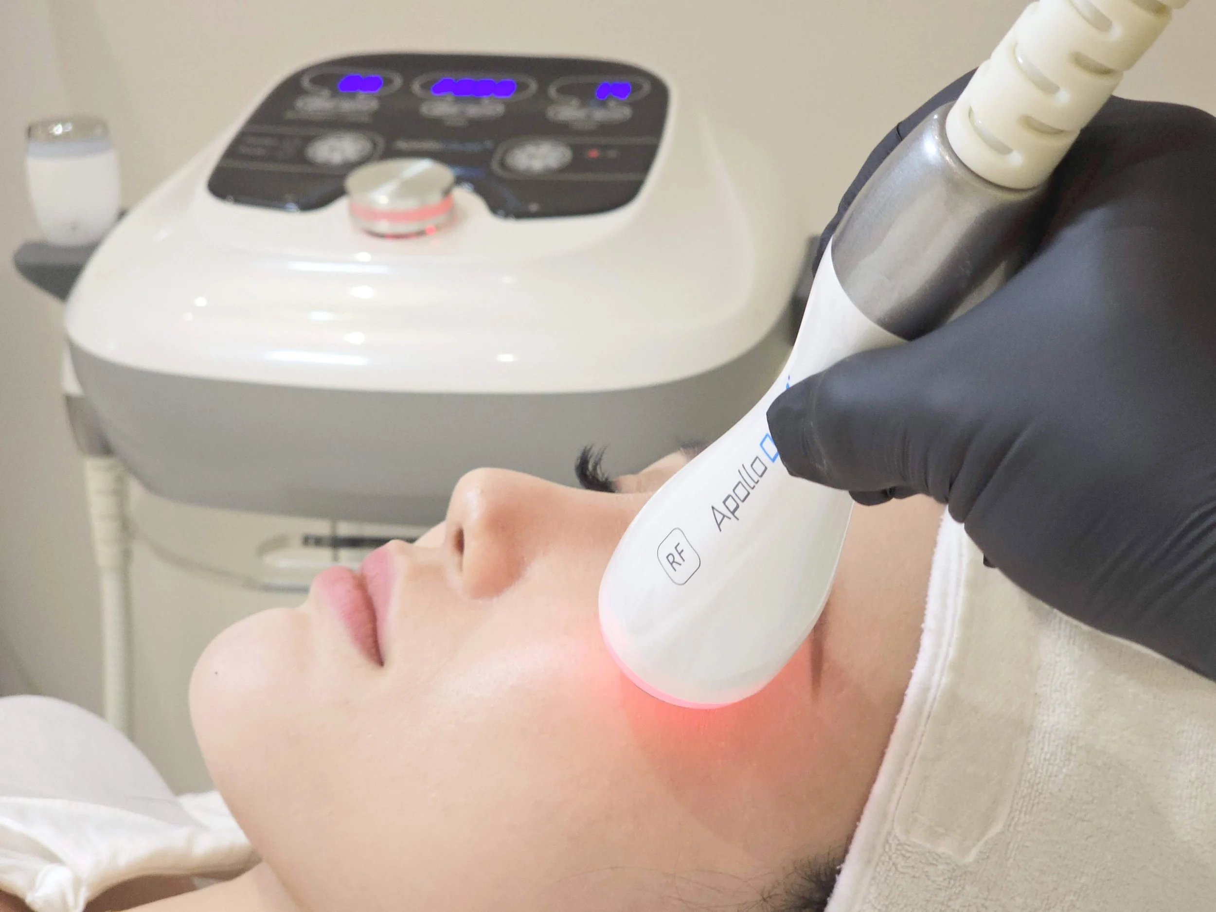 Ionic RF Facial Contouring treatment in progress