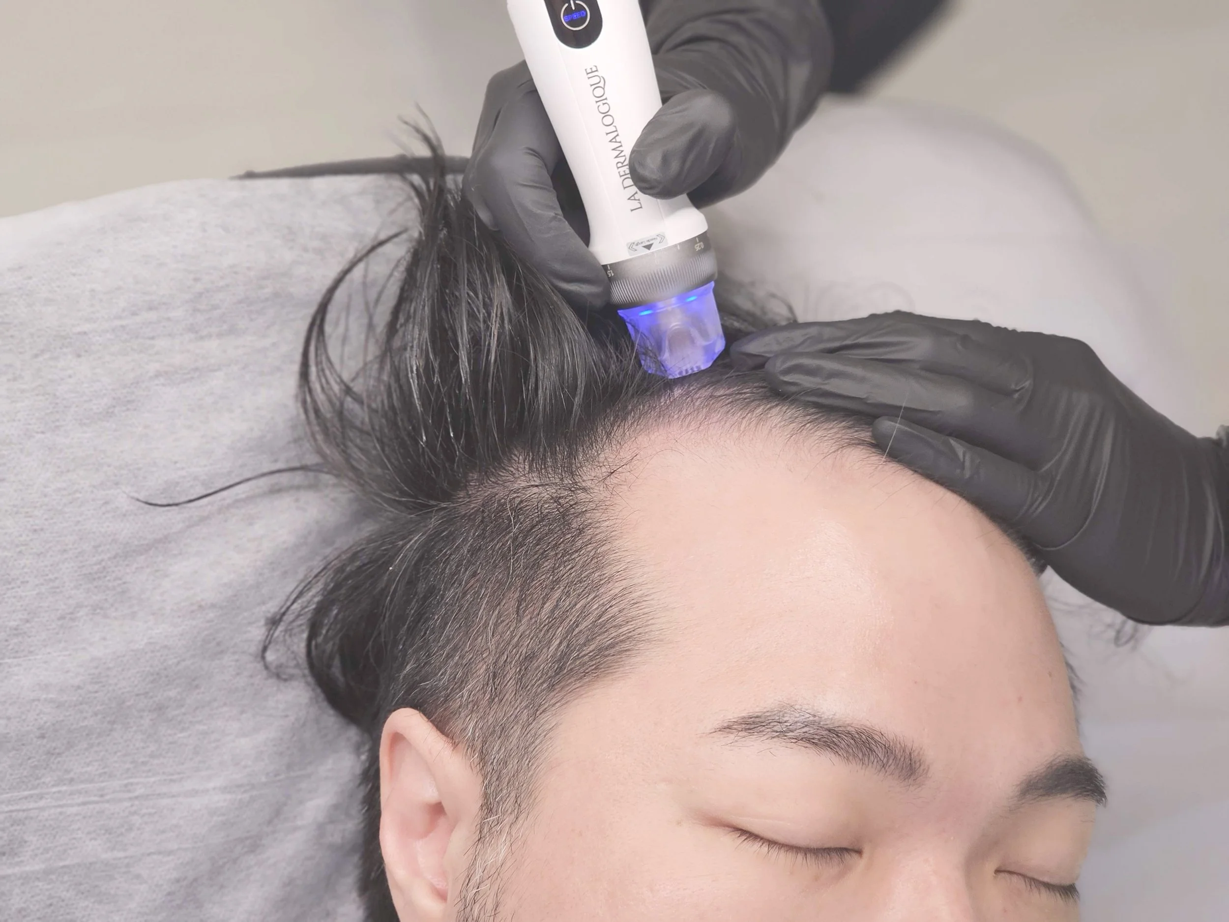 Red light therapy during Defensys treatment
