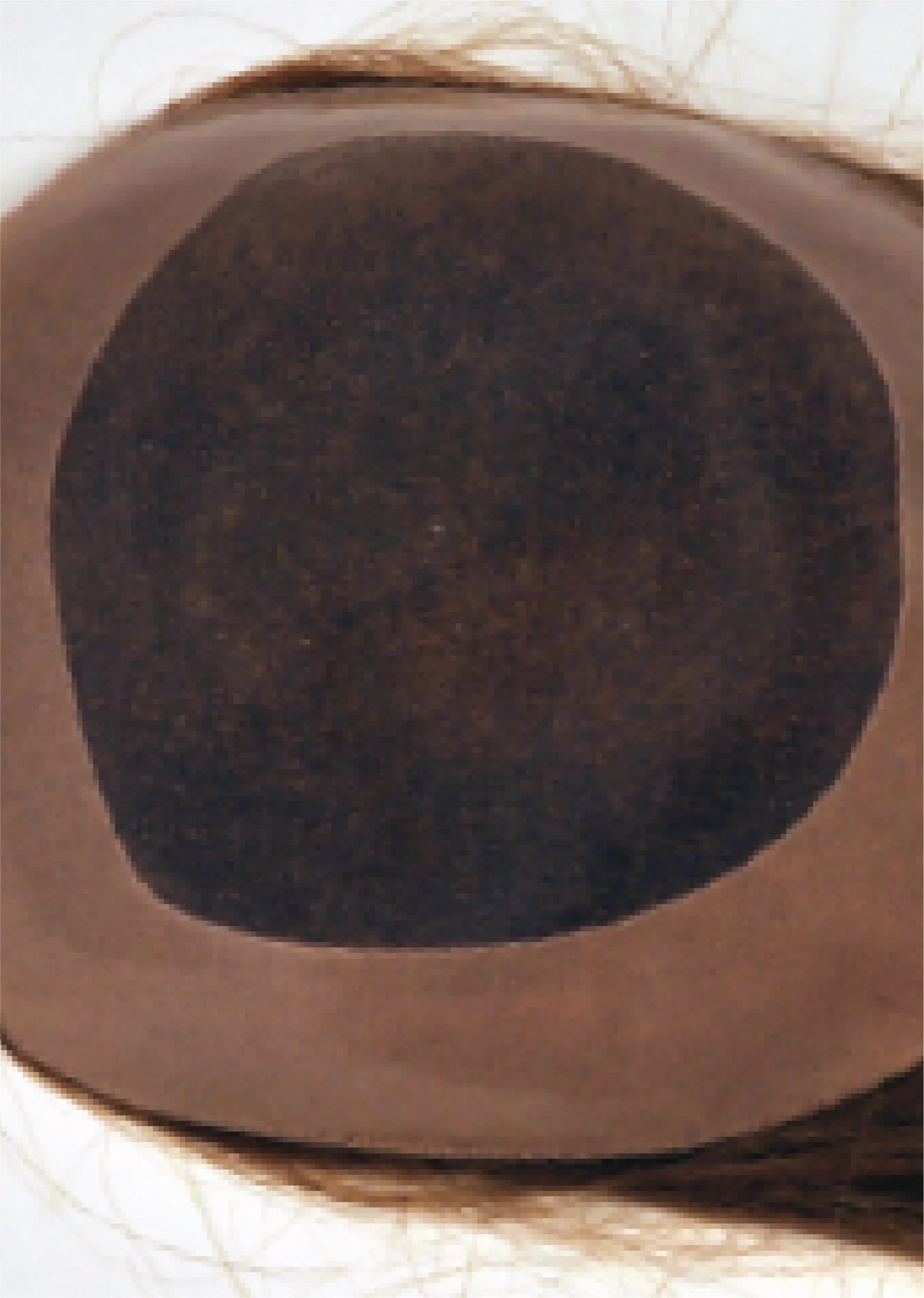 Part piece hair system example at Another Look Hair Institute