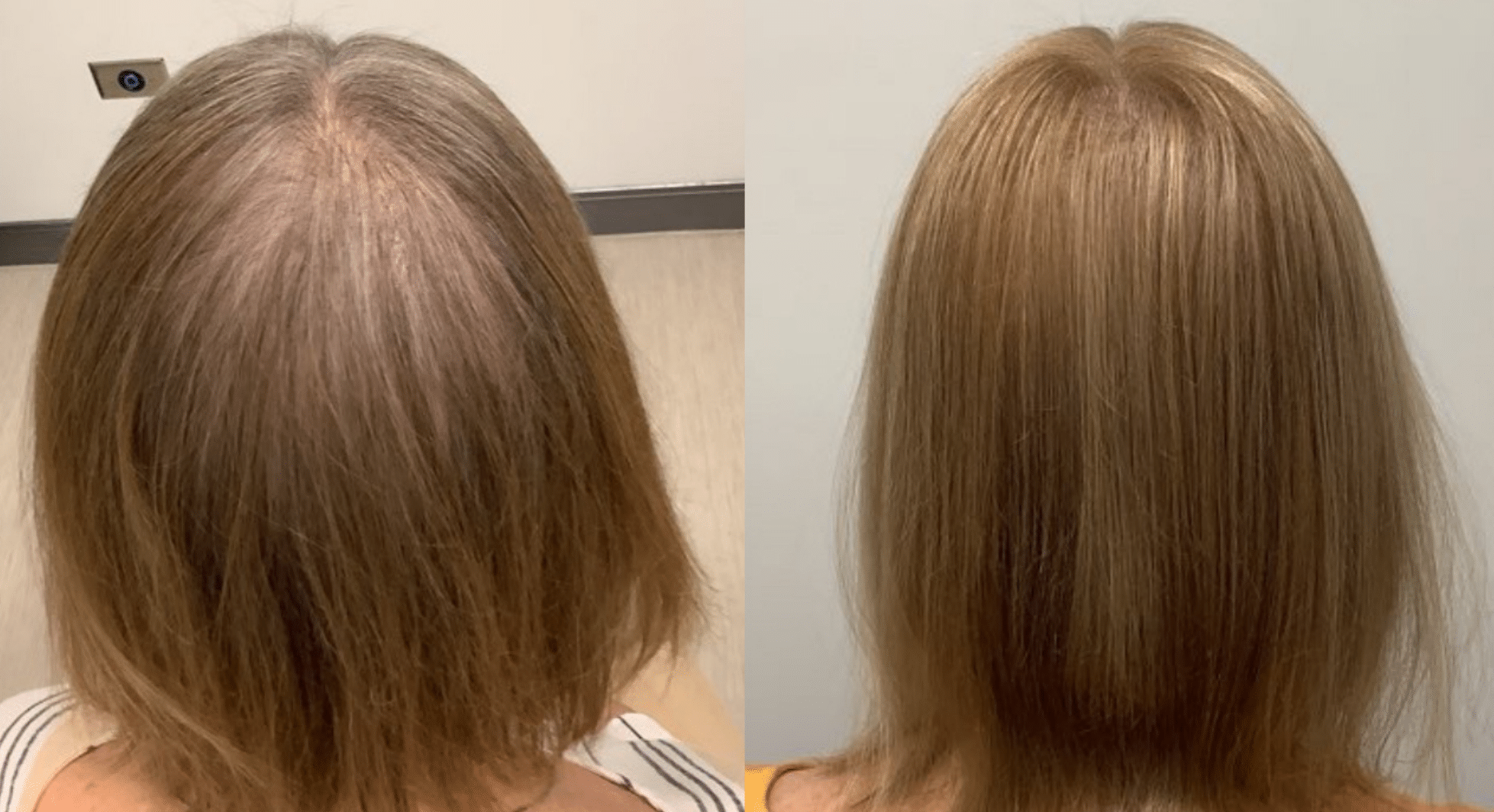 Another Look Hair Institute salon and treatment setting