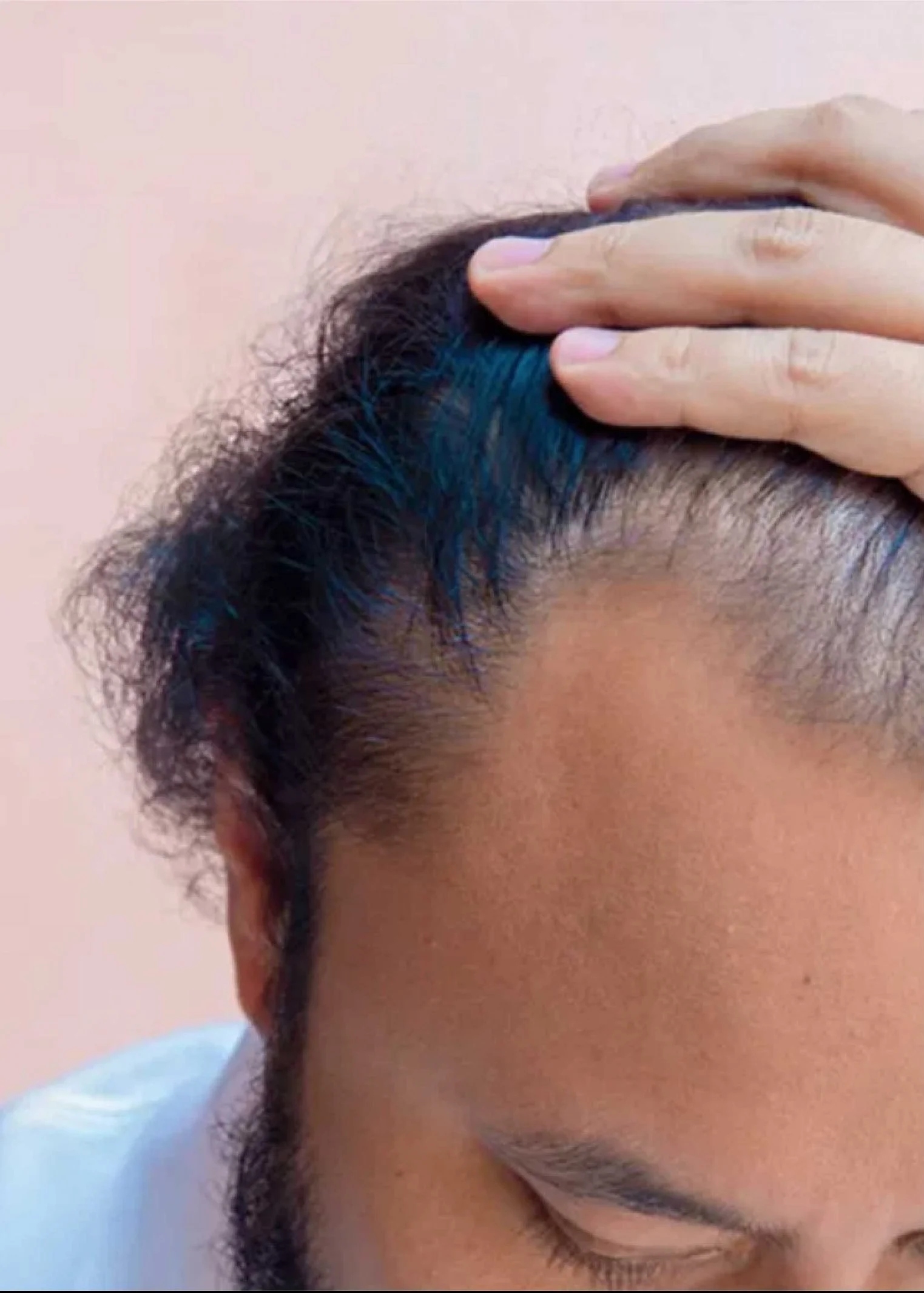 Close-up of scalp and hairline for trichology hair loss evaluation