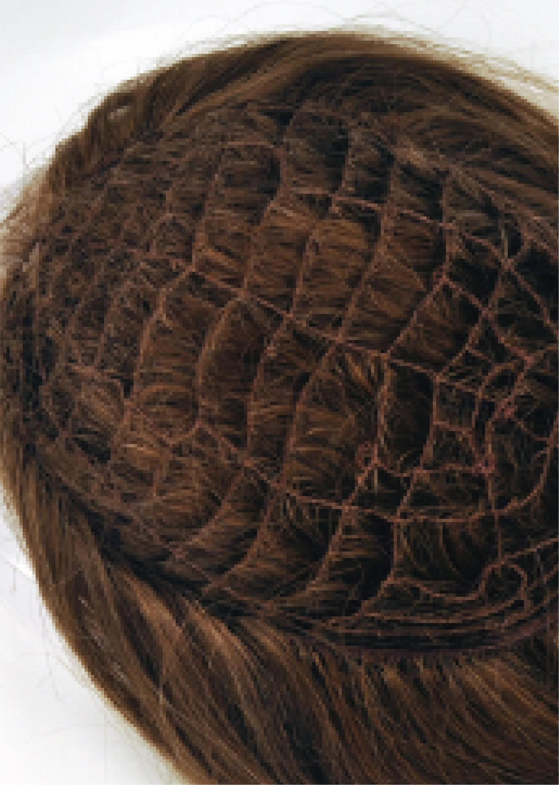 Integration piece hair system example at Another Look Hair Institute