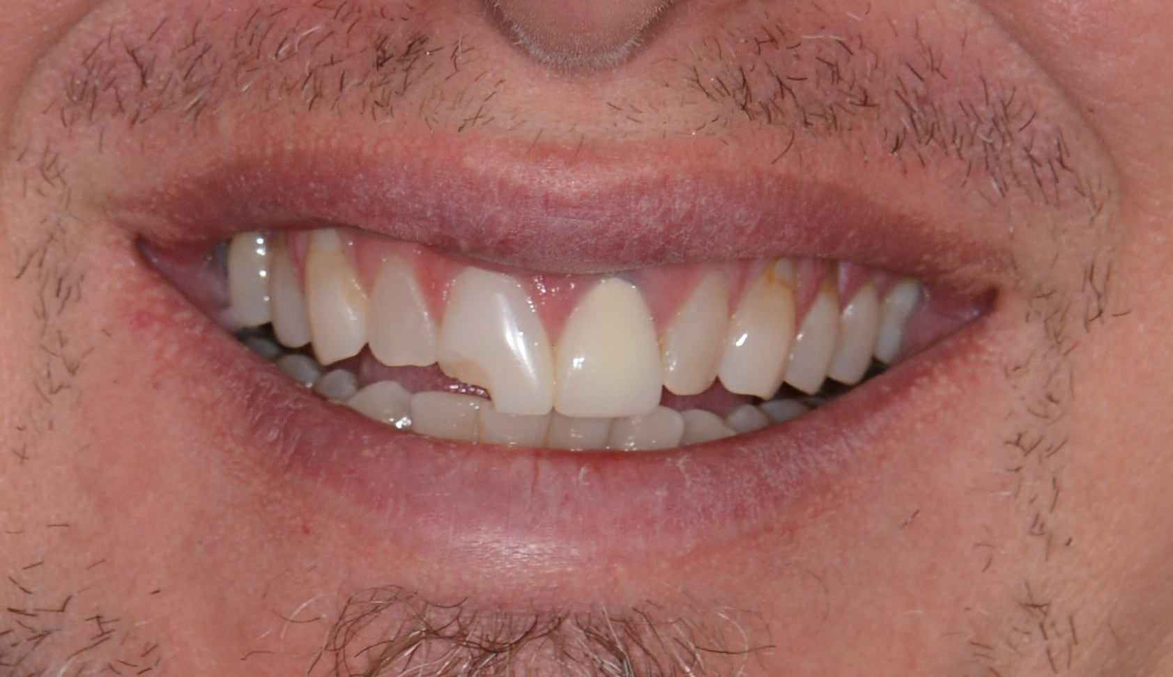 After