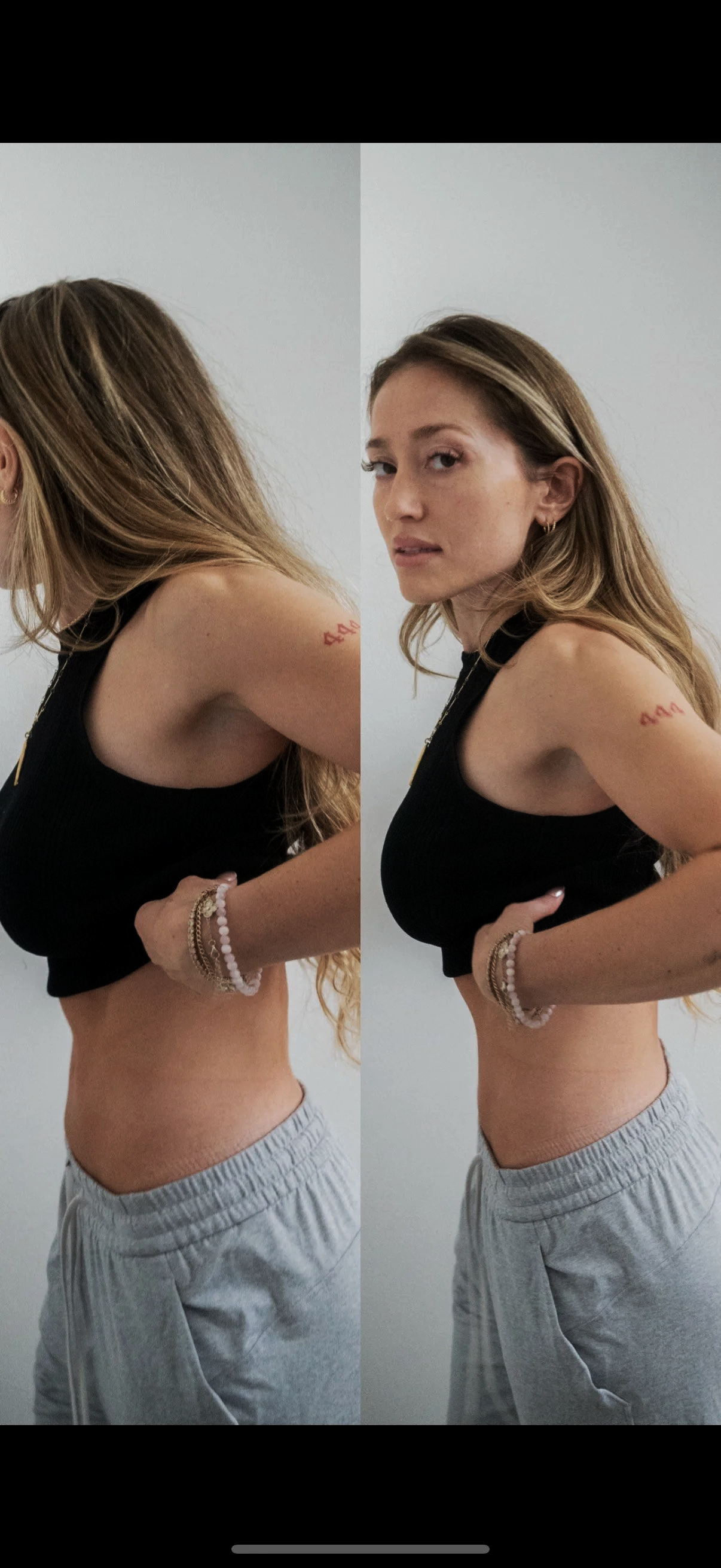 How Emsculpt works