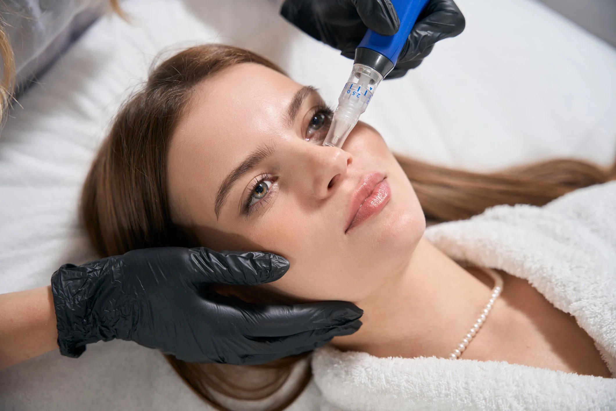 Microneedling treatment at Persis Skincare