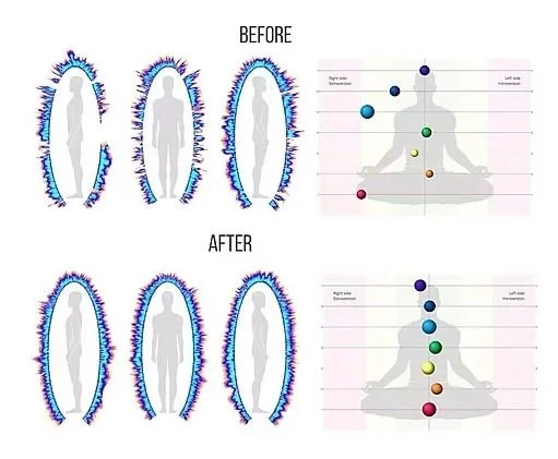 Bio-Well Scanner