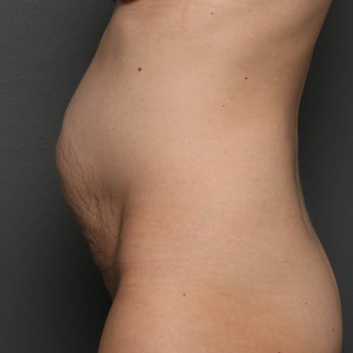arms