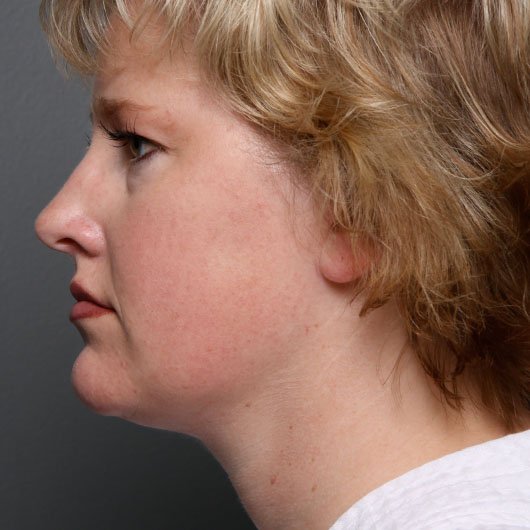 neck