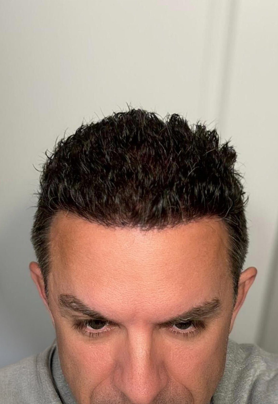After Image