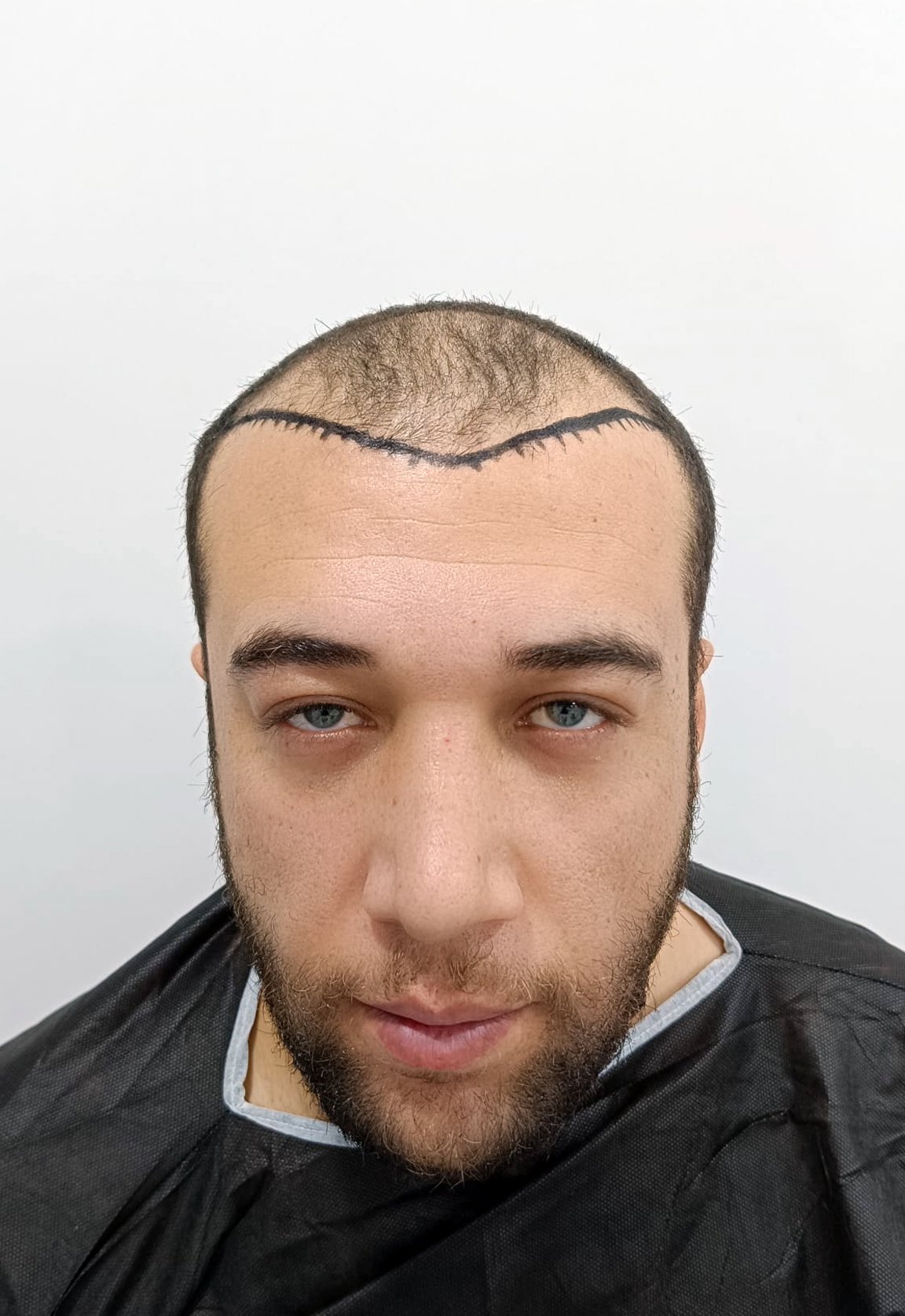 Before Image