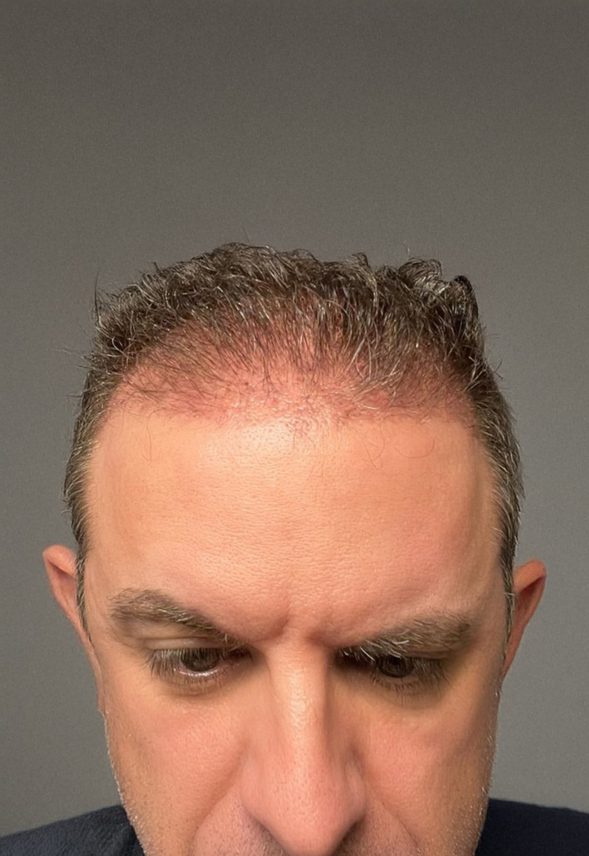 Before Image