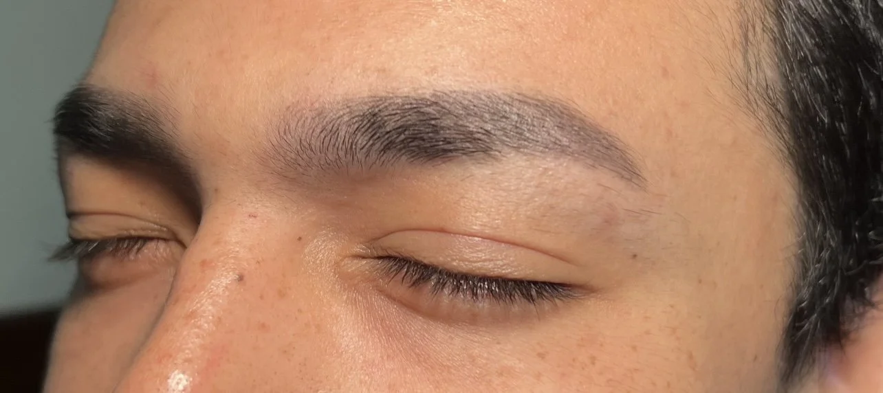 Before