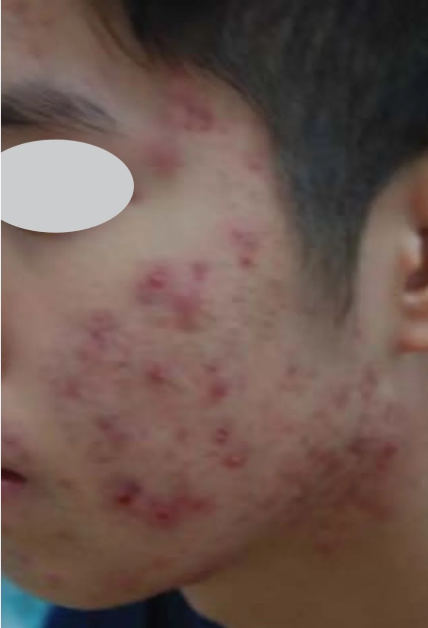 After