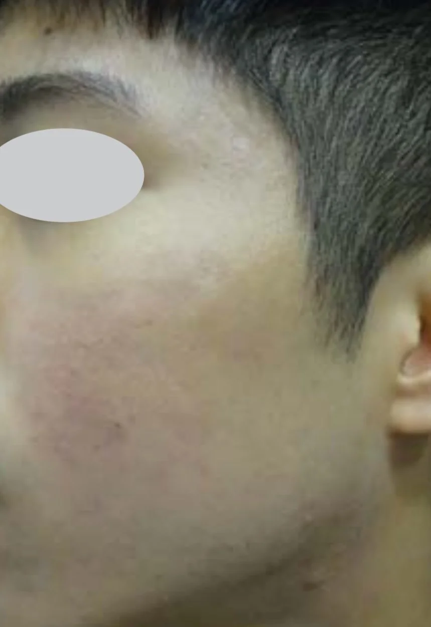 Before